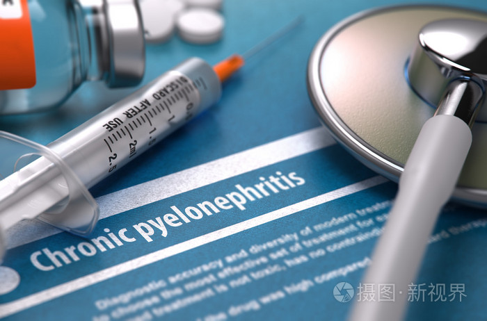 诊断慢性肾盂肾炎 医学概念 照片 正版商用图片1kkcy1 摄图新视界