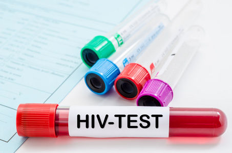Hiv 检测的血液样本