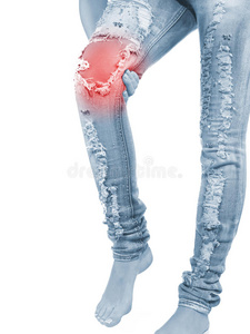 女人膝盖痛。