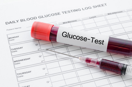 日常血糖测试和样品血液在管和注射器