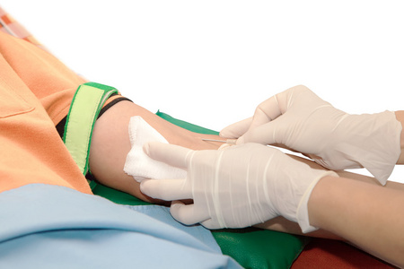 上白孤立的献血，护士刺穿血献血者手臂静脉针空白管。