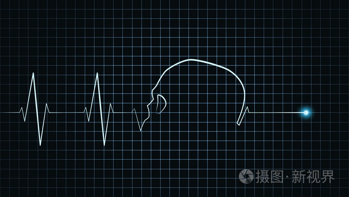 心跳停止心动图