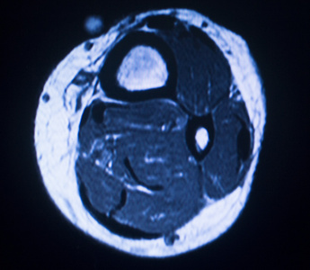 mri 磁共振成像医学扫描