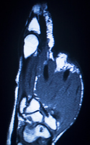 mri 磁共振成像医学扫描