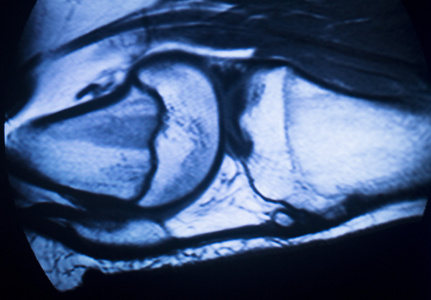 mri 磁共振成像医学扫描