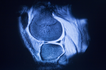 mri 磁共振成像医学扫描