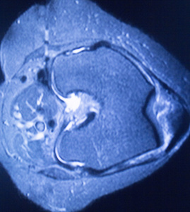 mri 磁共振成像医学扫描