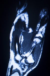 mri 磁共振成像医学扫描