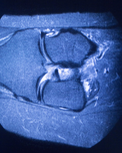 mri 磁共振成像医学扫描