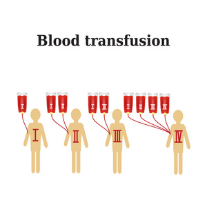 输血。血型。信息图表。矢量图