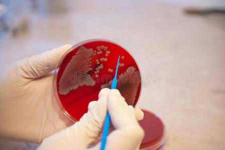 实验室医生拿着接种环和大肠埃希菌培养皿.医学实验室概念照片