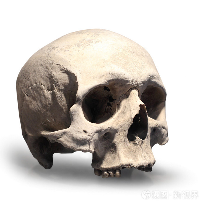 恼火!颅骨突出图"登峰造极"-第2张图片-霓裳博客