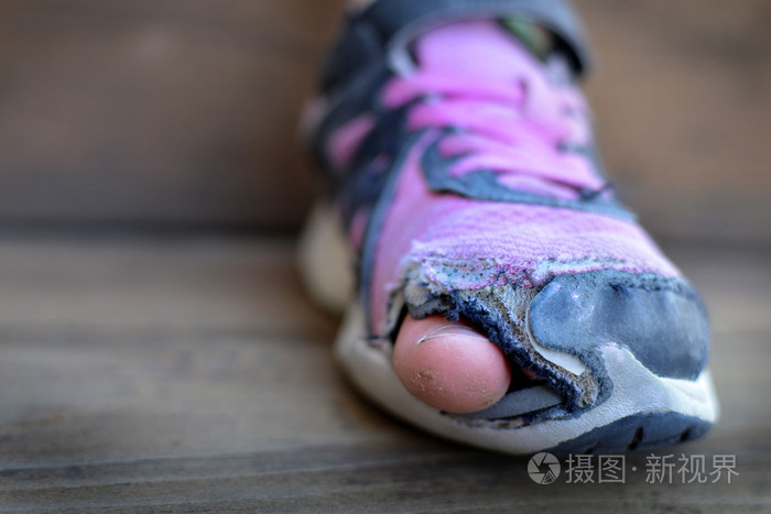 与孔无家可归脚趾露在外面的旧鞋子