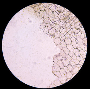 显微镜下观察植物细胞照片