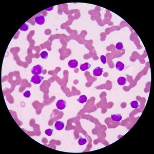 小红色粉红色正常红血细胞或红细胞