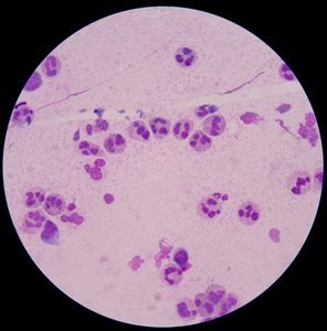 炎症因子化学和细胞因子参与炎症的响应照片