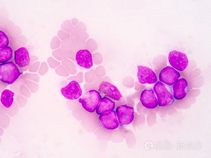 显示爆炸细胞(aml)的医学科学背景照片-正版商用图片1lfk4z-摄图新视