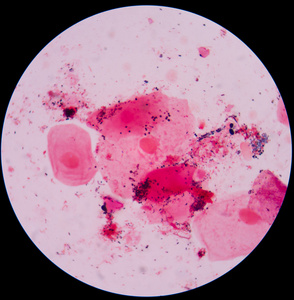 蓝细菌革兰氏染色红色背景革兰氏染色试验显示细菌细胞