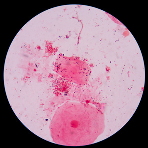 细菌分枝芽殖酵母细胞和假菌丝在尿克圣