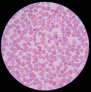 医学背景红血细胞照片