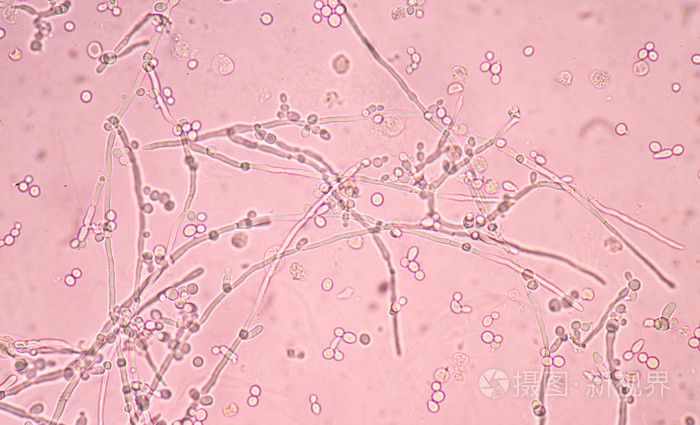酵母菌出芽生殖图片图片