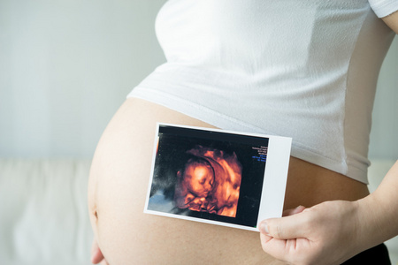孕妇与超声扫描图片图片