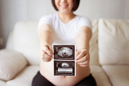 孕妇与超声扫描图片