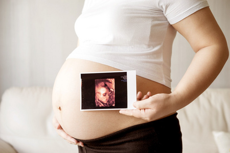 孕妇与超声扫描图片