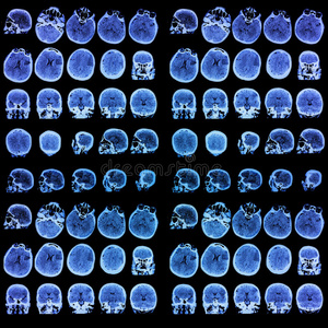 医学断层摄影照片。背景