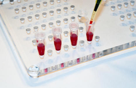 实验室 诊所 实验 材料 玻璃 医学 塑料 化学 液体 生物技术