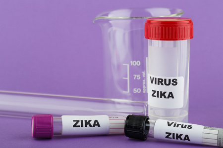 测试管 Zika 概念照片