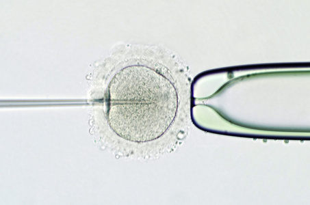 人工受精的卵胞浆内单精子显微注射技术照片