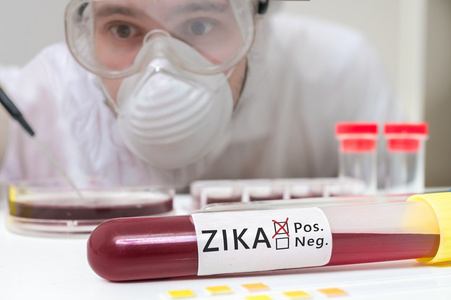 以血代 Zika 病毒试管测试前研究员