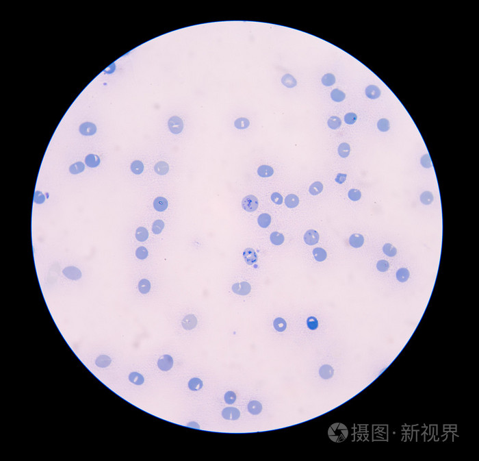 网织红细胞计数染色微