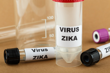 测试管 Zika 病毒概念照片