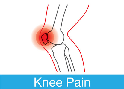 蓝色,黑底及炎症区红色的膝关节x线图像膝关节疼痛,腿痛,脊椎按摩治疗