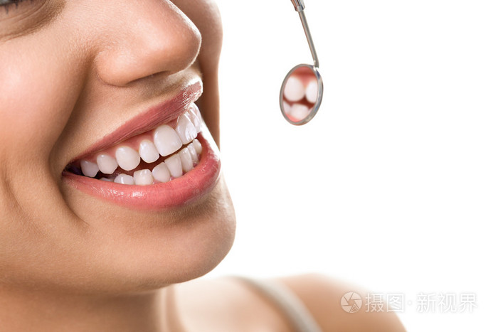 健康的牙齿与口腔镜微笑患者的特写镜头