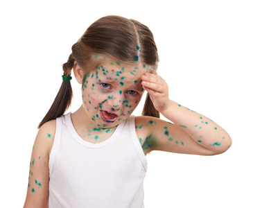 生病的孩子有这种病毒在皮肤上