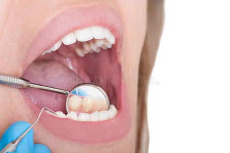 牙科镜反射下牙