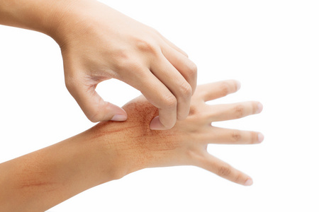 妇女抓痒用隔离在白色背景上的手照片