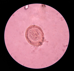 在凳子上考试中寄生虫卵蓝色弯曲的圆形的张贴物或标