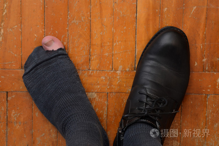男子脚穿一只鞋和破的袜子