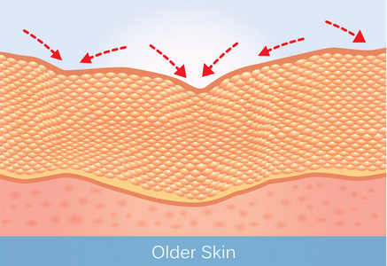 在老人的皮肤条件