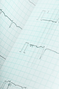 心电图医学背景图片