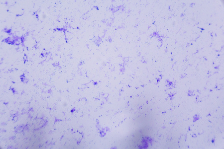 神经细胞在显微镜下白坝抽象蓝色的点