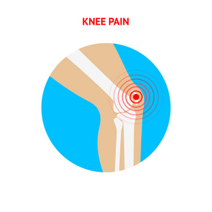 膝盖疼。 膝盖疼痛图标孤立在白色背景上。