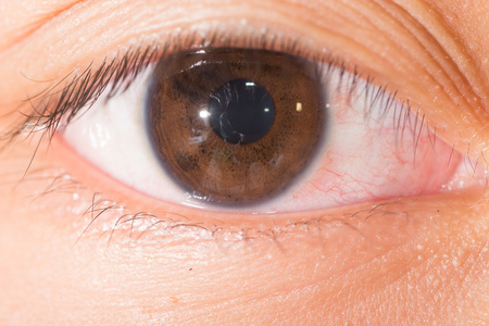 检查眼睛虹膜结节人类的眼睛截面近视视力障碍正常人眼视觉人类的眼睛