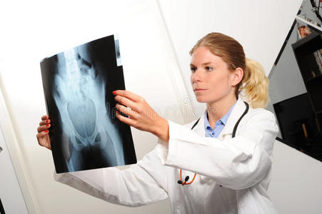 女性医生检查X光图像