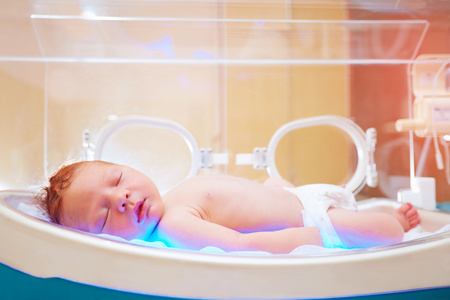 刚出生的婴儿在婴儿培养箱得到光疗法