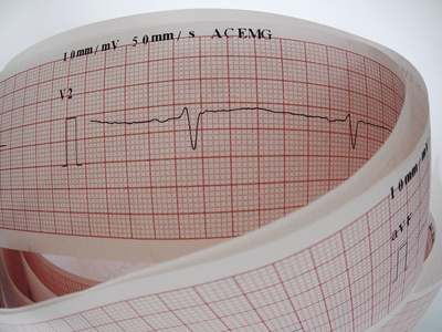 心脏疾病问题分析心电图的特写